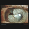 Anaestesia